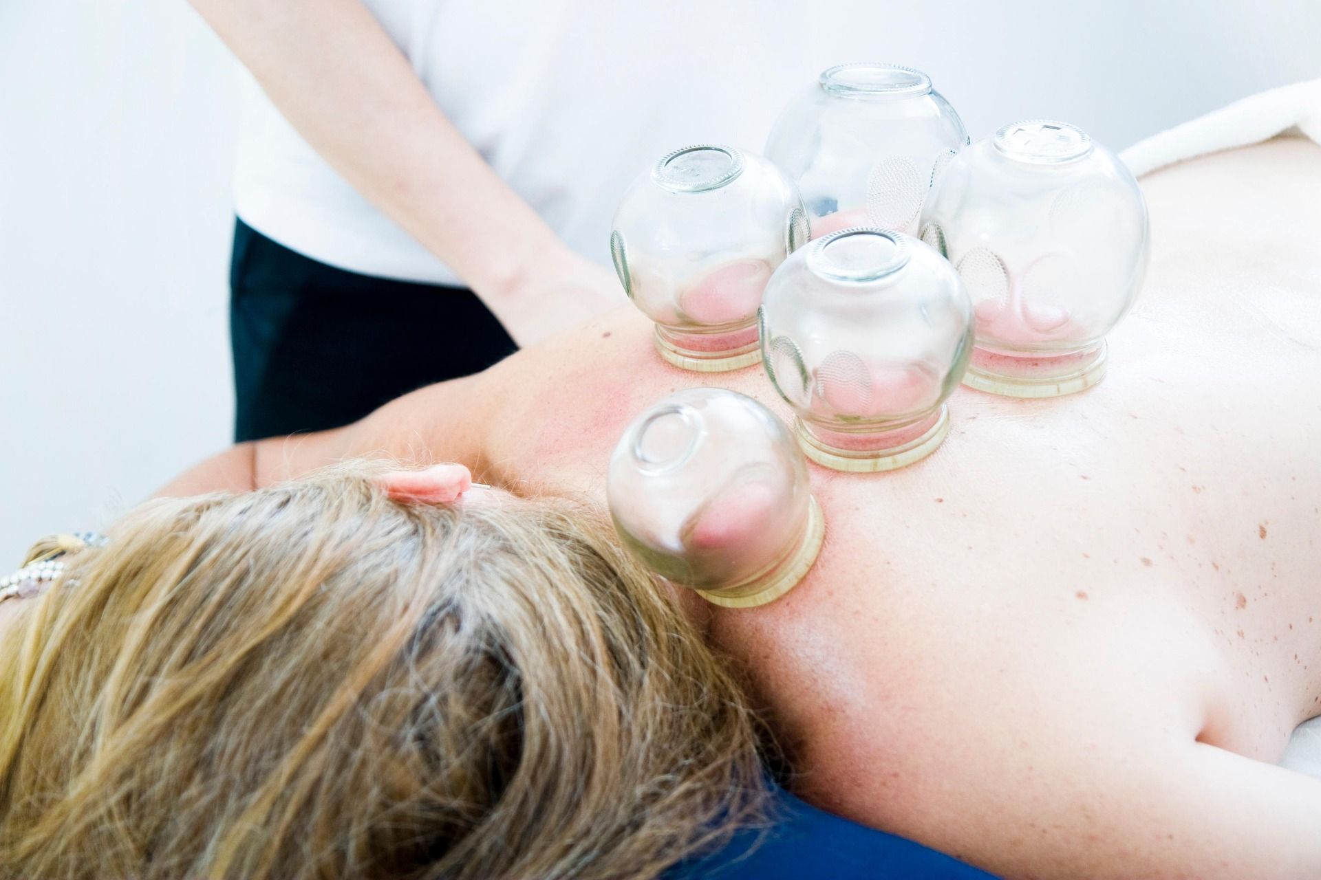 cupping-therapy-6604217_150.jpg